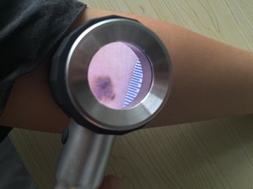 Hospital Viedo Dermatoscope Skin Scanner Magnifying Glass On Skin And Hair