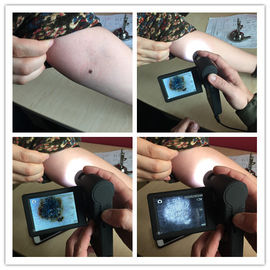 มืออาชีพวิดีโอตรวจสอบผิวหนังผิวหนังอิเล็กทรอนิกส์ด้วย Micro SD การ์ด