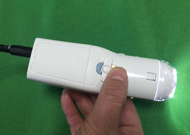 กล้องดิจิตอลทางช่องคลอดเพื่อหาโรคปากมดลูก Eealier