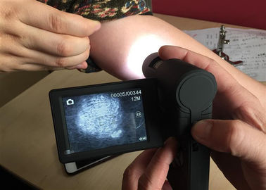Video Skin Microscope Dermatoscope แบบพกพาพร้อมจอแสดงผลสี TFT ขนาด 3 นิ้ว
