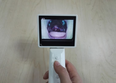 SD Card Storage ENT อุปกรณ์การวินิจฉัย Otoscope Ophthalmoscope โดยอัตโนมัติด้วยสาย USB