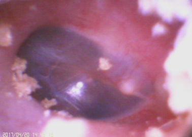 3.5 นิ้วจอ lcd ENT Endoscopy มือถือวิดีโอ O Toscope Ophthalmoscope ฟังก์ชั่นไร้สายตัวเลือก