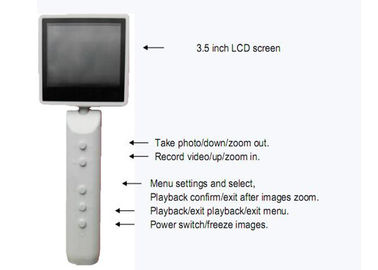กล้องวิดีโอมือถือ Ophthalmoscope Otoscope ดิจิตอลวิดีโอวินิจฉัยด้วยเอาท์พุท USB ตัวเลือกการเชื่อมต่อ WIFI
