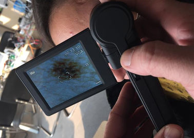 วิดีโอ Dermatoscope กล้องจุลทรรศน์ดิจิตอลวิเคราะห์ผิว USB ผิวตรวจสอบพื้นผิวที่มี 3 นิ้วจอภาพ