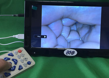 เอาท์พุทวิดีโอกล้องดิจิตอล Colposcope นรีเวชวิทยาแบบดิจิตอลเต็มรูปแบบพร้อมคู่มือผู้ใช้