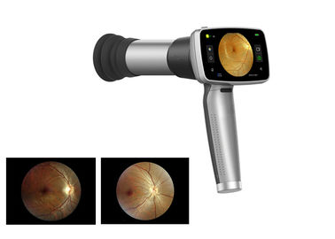 Video Ophthalmoscope 45 ° Handheld Fundus Camera