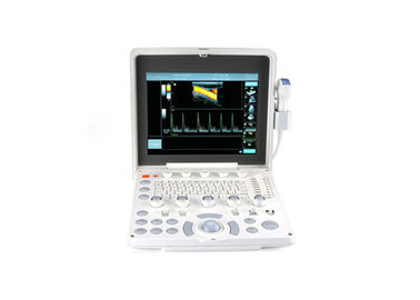 Color Doppler Ultrasound System เครื่องสแกนอัลตร้าซาวด์พกพาขนาด 12.1 นิ้วพร้อม LED Monitor และ 2 Probe Ports