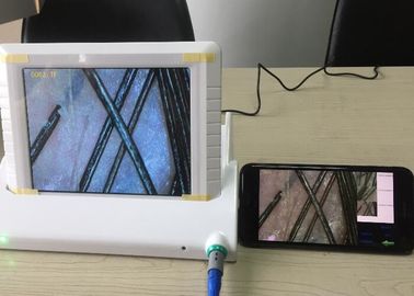 ดิจิตอลแว่นขยายมือถือวิดีโอ Dermatoscope วิเคราะห์ผิวด้วยรายงานข้อมูลของน้ำมันความชื้นเม็ดสีที่มีความยืดหยุ่น