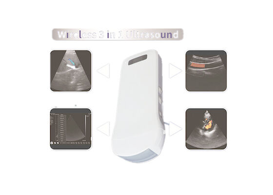 เครื่องสแกนอัลตร้าซาวด์มือถือไร้สายดิจิตอลการเชื่อมต่อ Wifi Cardiac Linear Convex 3 IN 1 Wireless Charging 6 ภาษา