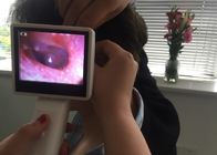 3.5 นิ้วหน้าจอทางการแพทย์ USB วิดีโอ O Toscope วิดีโอดิจิตอลที่มีภาพที่ชัดเจน Rhinoscope Laryngoscope ตัวเลือก