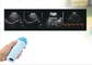 เครื่องสแกนแบบพกพากระเพาะปัสสาวะแบบพกพา Micro Convex Probe Ultrasound Veterinary Pregnancy