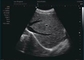 Doppler Ultrasound In Pregnancy Home Doppler Ultrasound Probe ความถี่ 12MHz