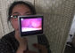 ENT Endoscopy Rhinoscopy กล้องวิดีโอทางการแพทย์ Otoscope ดิจิตอลสำหรับการตรวจสอบจมูกด้วยหน้าจอแอลซีดี