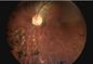การตรวจสอบ Ophthalmoscope H.264 Digital Fundus Camera