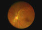 Ophthalmic Optical Equipment คอกล้องวิดีโอ Otoscope Dermatoscope กล้อง Endoscope ระบบดิจิตอลที่มี 2 ล้าน Pixels