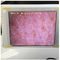 White Wifi Skin Moisture Checker เซ็นเซอร์ความชุ่มชื้นของผิวพร้อมรูปถ่ายแสดงใน Ipad