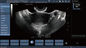Transvaginal Probe Color Doppler Ultrasound Scanner สำหรับการตั้งครรภ์