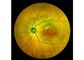 Retina Angiograph Digital 160 ° Ophthalmic Equipment