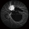 Confocal Retina Opthalmoscope กล้องดิจิตอล Fundus พร้อม FOV 15 °, 30 °, 60 °ขนาดภาพ 1024 * 1024