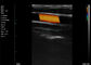 Echo Handheld Color Doppler Linear Scans Carotid Artery ความถี่ 7.5-10MHz