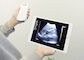 Ultrasound Color Doppler Diagnostic Ultrasound Equipment ดาวน์โหลดซอฟต์แวร์จาก App Store หรือ Google Play 3 In 1 Wireless