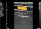 เครื่องอัลตร้าซาวด์สี Home Ultrasound Scanner เครื่องอัลตร้าซาวด์แบบพกพาสำหรับการตั้งครรภ์ 8 TGC 3.5 ~ 10 MHz