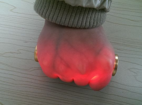 Venipuncture Infrared Vein Finder