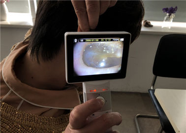 มือถือวิดีโอดิจิตอล Otoscope Dermatoscope Ophthalmoscope ที่มีความละเอียดสูง