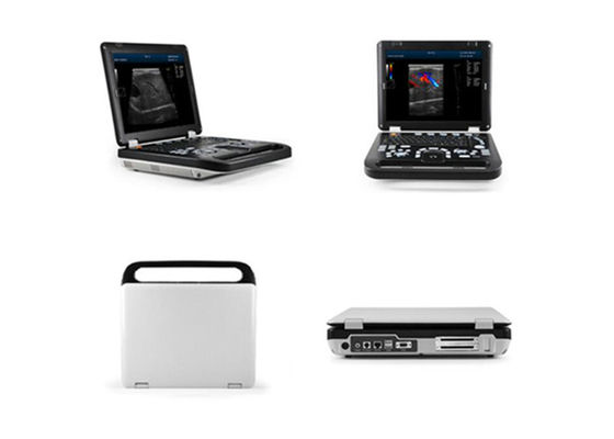 15 นิ้ว LED วินิจฉัยมนุษย์สี Doppler เครื่องสแกนเนอร์อัลตราซาวนด์ที่มี 2 P Robe การเชื่อมต่อ