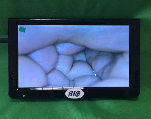 คอลปอสโกป์อิเล็กทรอนิกส์ดิจิตอลพกพา