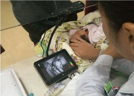 เครื่องมือค้นหาหลอดเลือดดำแบบอินฟาเรดแบบประหยัด