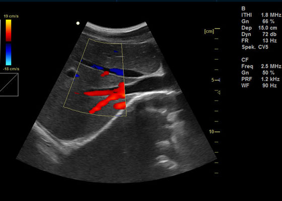 15 นิ้วสีเต็มรูปแบบดิจิตอลเครื่อง Doppler แบบพกพา Doppler การถ่ายภาพอัลตราซาวนด์ที่มี 2 พอร์ต USB