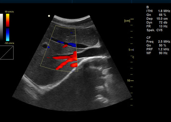 15 นิ้วสีเต็มรูปแบบดิจิตอลเครื่อง Doppler แบบพกพา Doppler การถ่ายภาพอัลตราซาวนด์ที่มี 2 พอร์ต USB