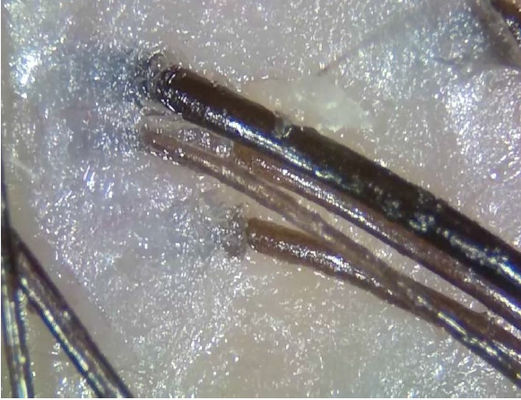 แบบพกพาไร้สายวิเคราะห์ผิวดิจิตอล Telemedicine อุปกรณ์การวินิจฉัยด้วยแสงโพลาไรซ์