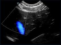 เครื่องตรวจจับลตร้าซาวด์แบบพกพาขนาดพกพาขนาดเล็กสี Doppler Probe เปลี่ยนแปลงได้ด้วยความถี่ 2 ~ 11MHz