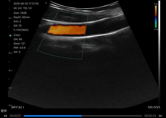 เครื่องสแกนเสียงฉลามมือถือแบบดิจิตอลไร้สาย