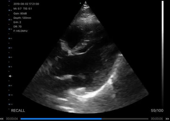 เครื่องสแกนเสียงฉลามมือถือแบบดิจิตอลไร้สาย