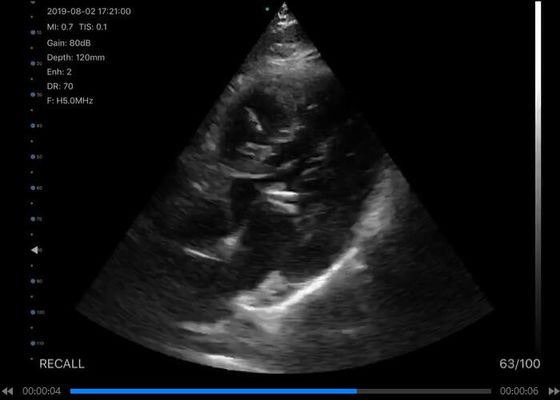 เครื่องสแกนอัลตร้าซาวด์มือถือ 5G นูน: 3.5 ~ 5MHz, เส้นตรง: 7.5 ~ 10MHz, หัวใจ: 2.5 ~ 5MHz