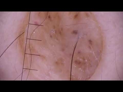 BIO-BS4 observes mole.mp4